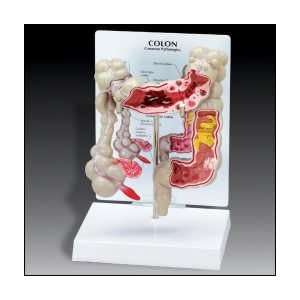 Anatomical Chart Company   Colon Model:  Industrial 