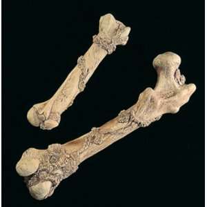  Humerus Bone Prop 