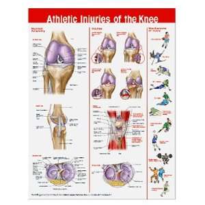  Athletic Injuries of the Knee Chart   Chart Health 