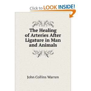   Arteries After Ligature in Man and Animals John Collins Warren Books