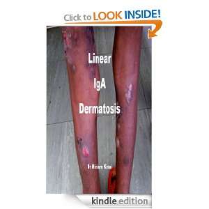 Linear IgA Dermatosis (Dermatology) Dr Miriam Kinai  