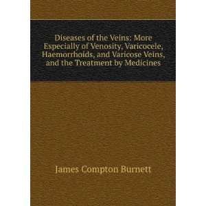   Varicose Veins, and the Treatment by Medicines James Compton Burnett